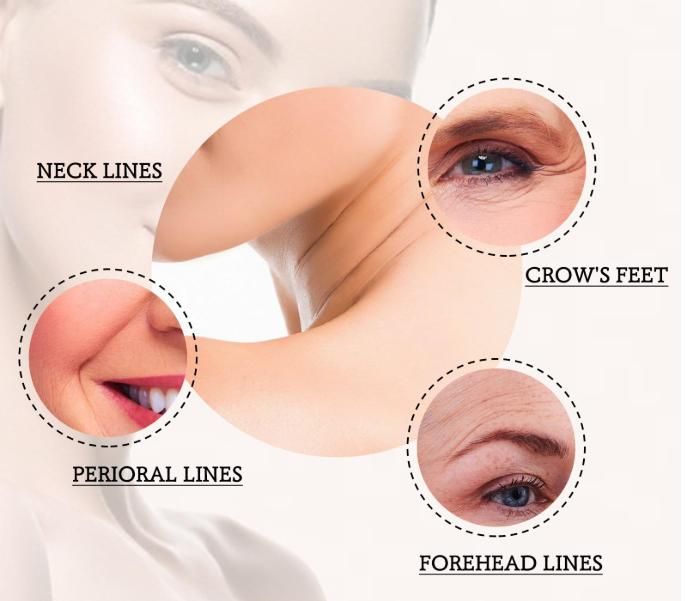 Botox Stock Solution Fade Skin Fine Line  30ML